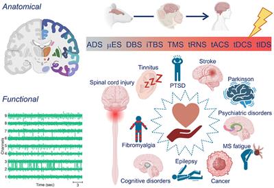 Personalized strategies of neurostimulation: from static biomarkers to dynamic closed-loop assessment of neural function